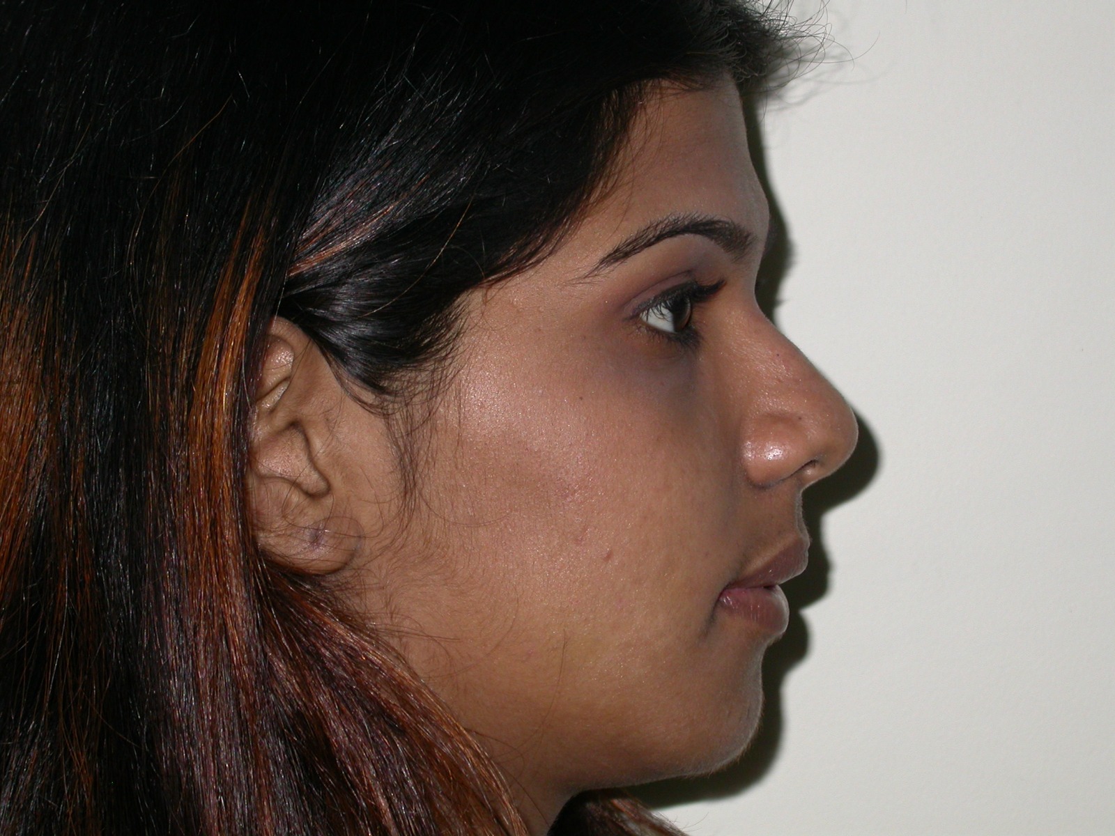 After image